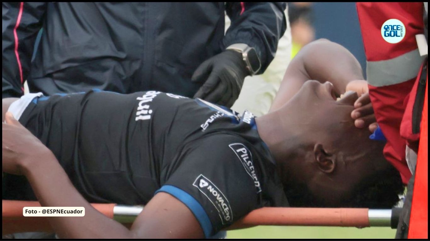 Defensor argentino, exPatronato, provocó una fractura expuesta a un jugador de Independiente del Valle | VIDEO